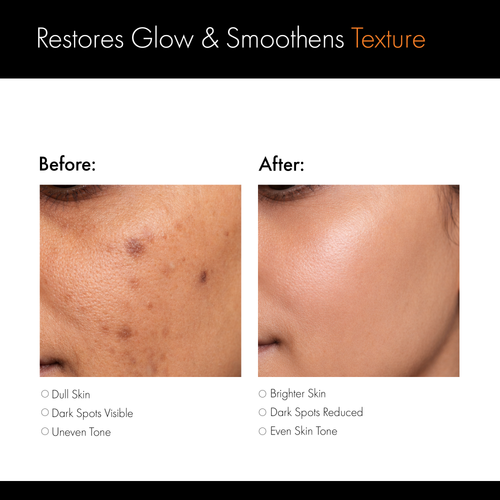 D'CLARA 2% Alpha Arbutin Serum | Dark Spot Corrector & Skin Brightening Serum | 30ml